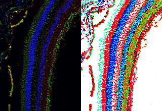 Image of a Spatial Sequencing scan